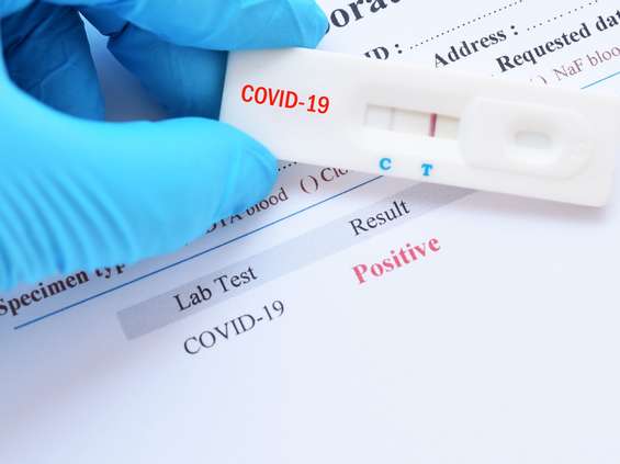 Testy na koronawirusa do kupienia w drogeriach? 